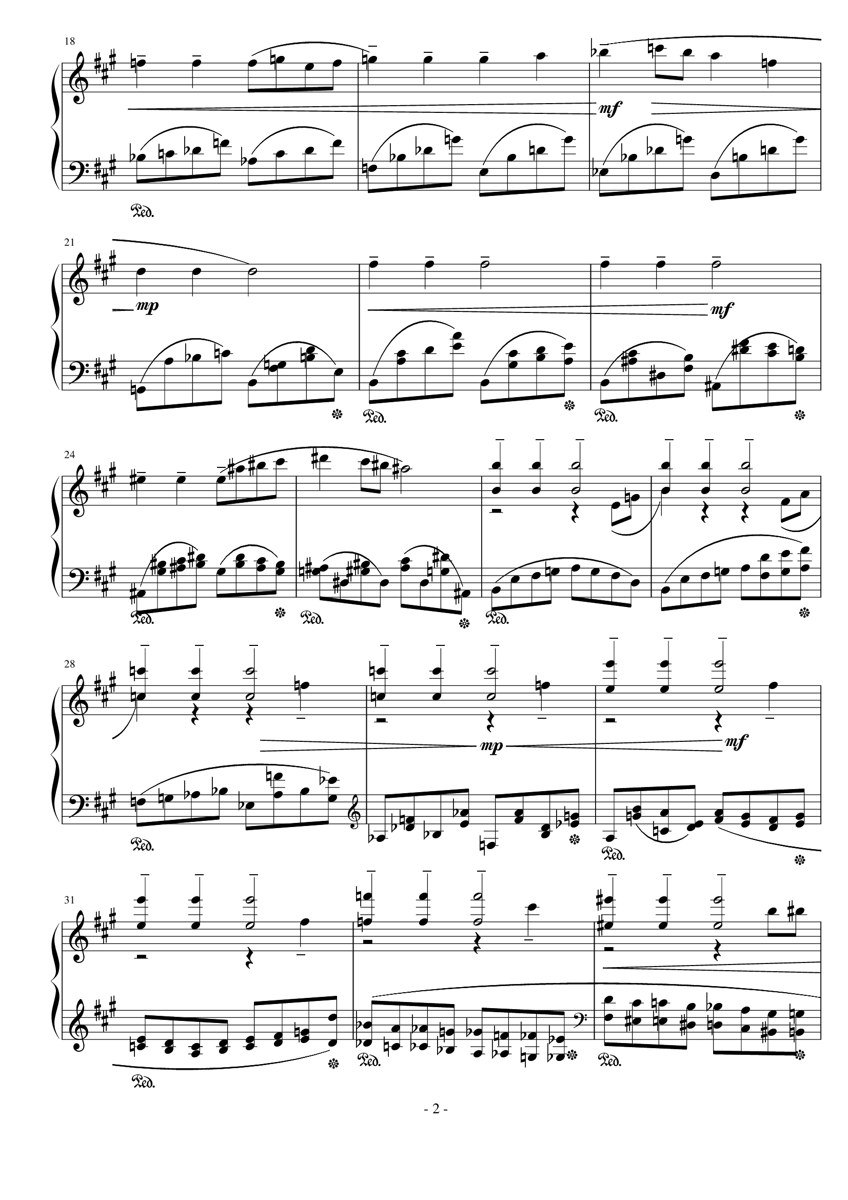 在那东山顶上, 小狂想曲